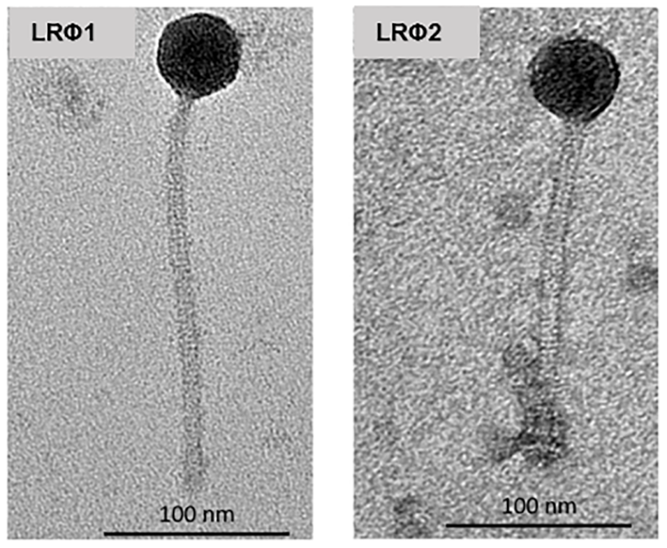 Electron micrographs of two prophages from this study.